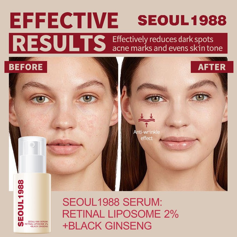 Seoul 1988 Eye Cream Retinol Eye Cream Improves Dark Circles and Eye Bags and Moisturizes