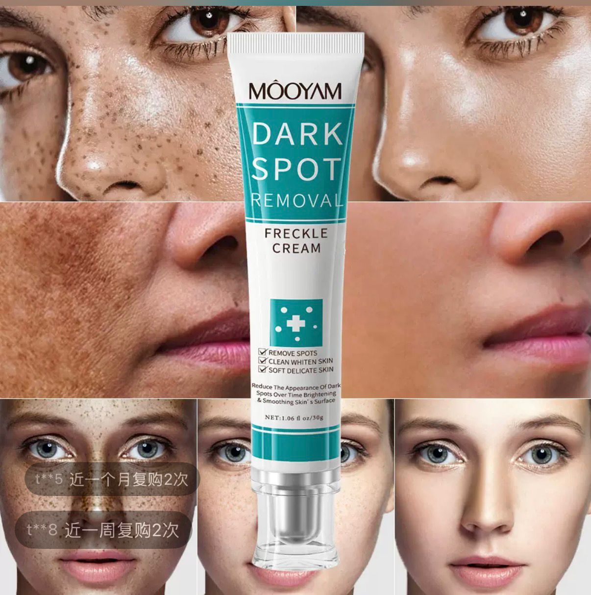 Mooyam Dark Spot Removal Freckle Cream for Face | Skin Brightening & Moisturizing Cream | Pigmentation, Acne Marks & Freckles Care